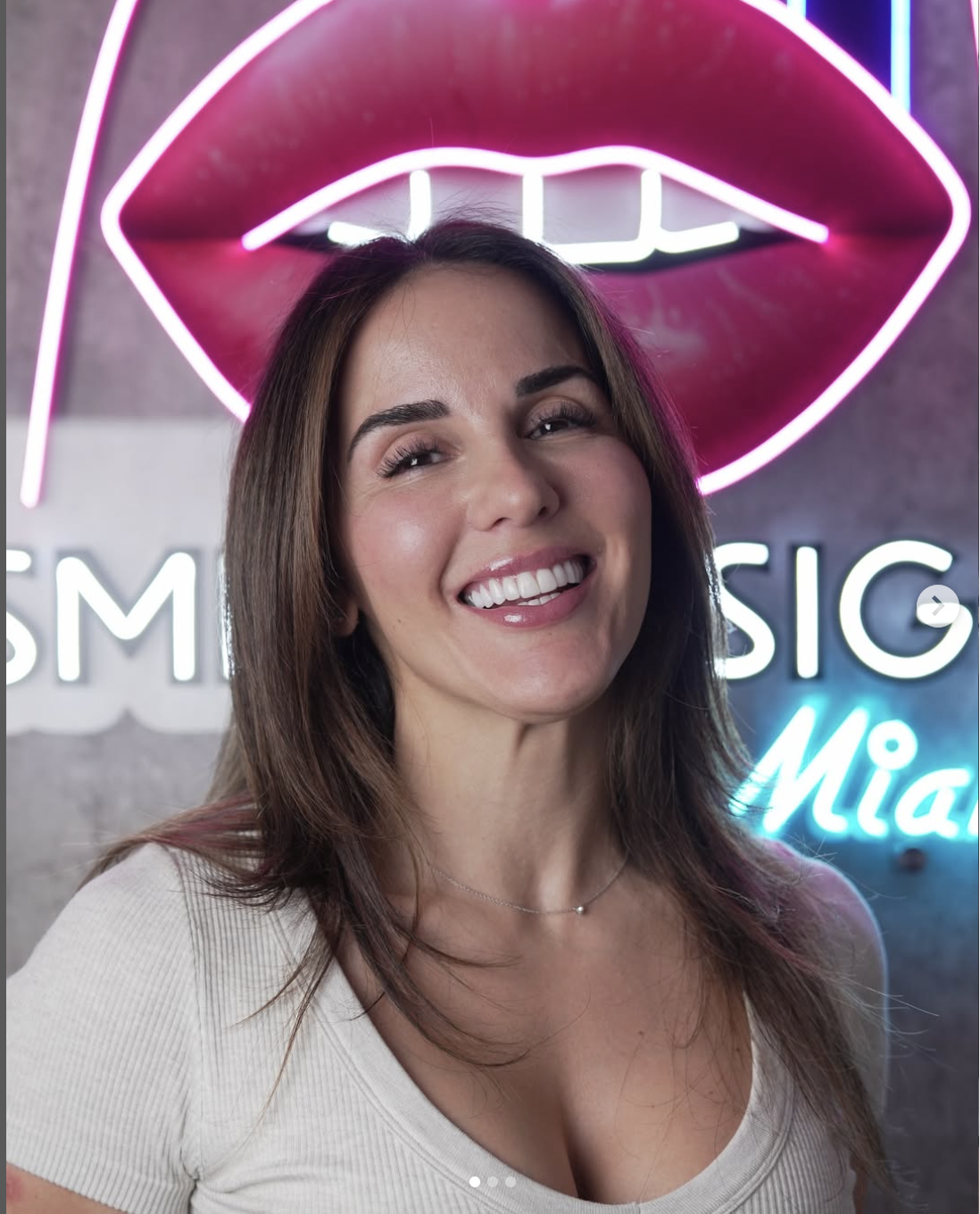 Veneers vs. Crowns Comparison