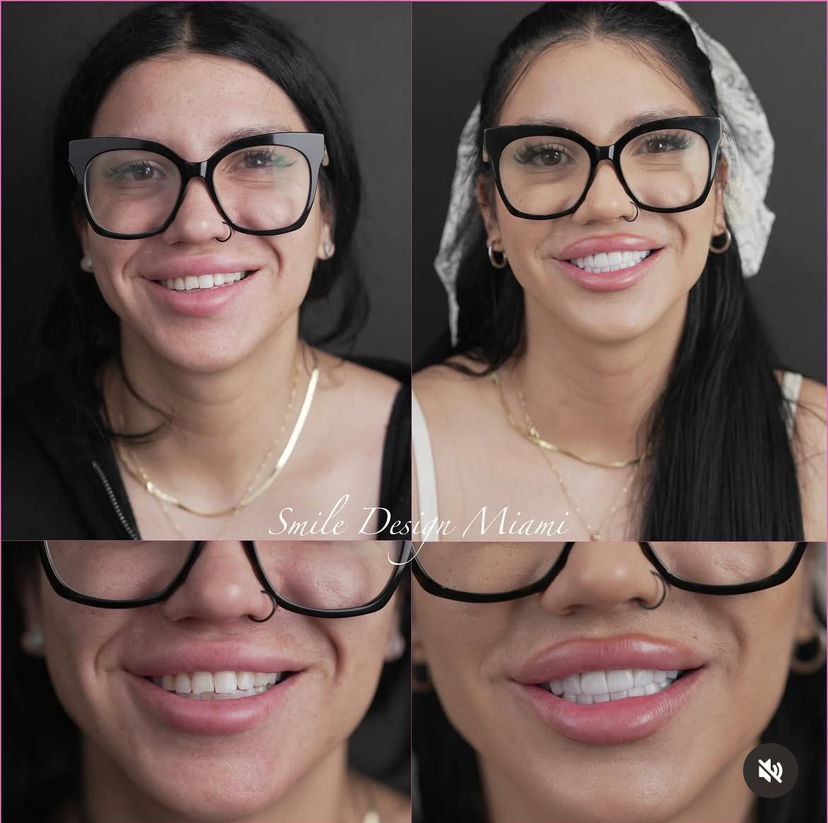 5 Ways to Maintain Your Smile