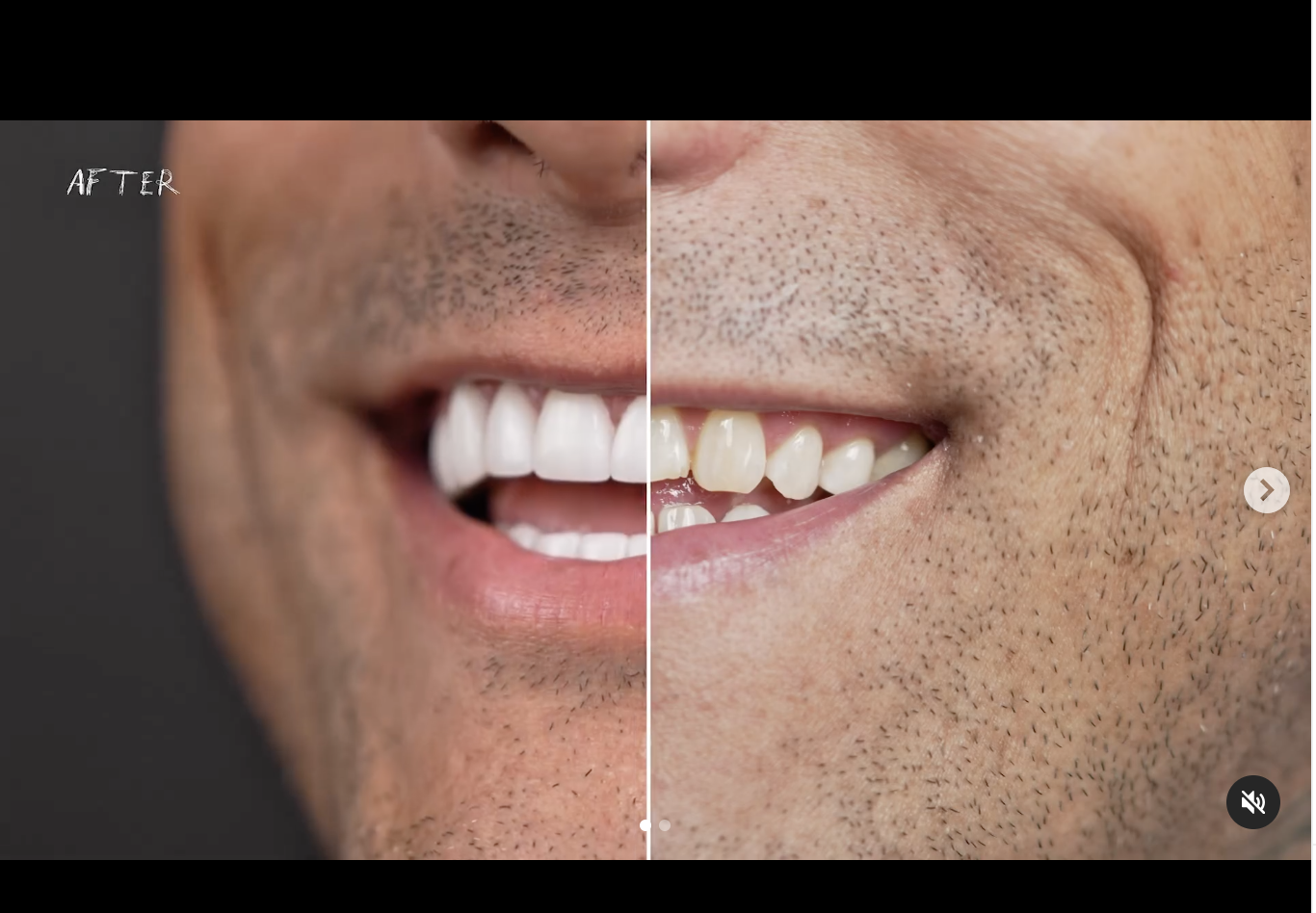 Maintain Your Smile