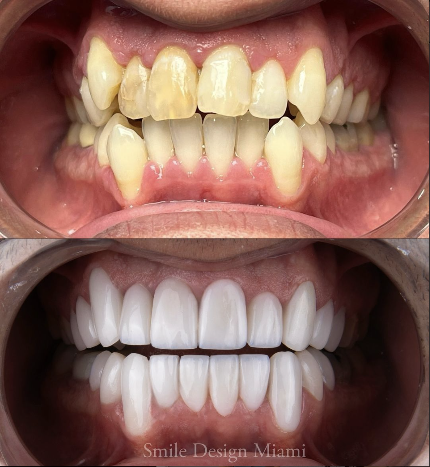 Before and After treatment comparison