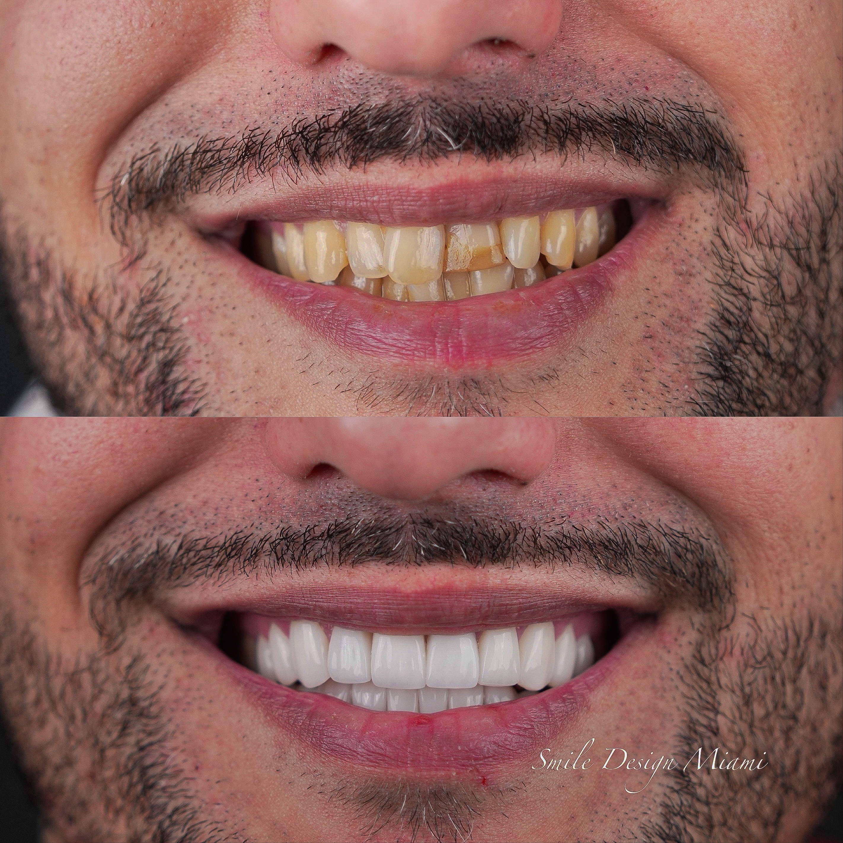Before and After treatment comparison