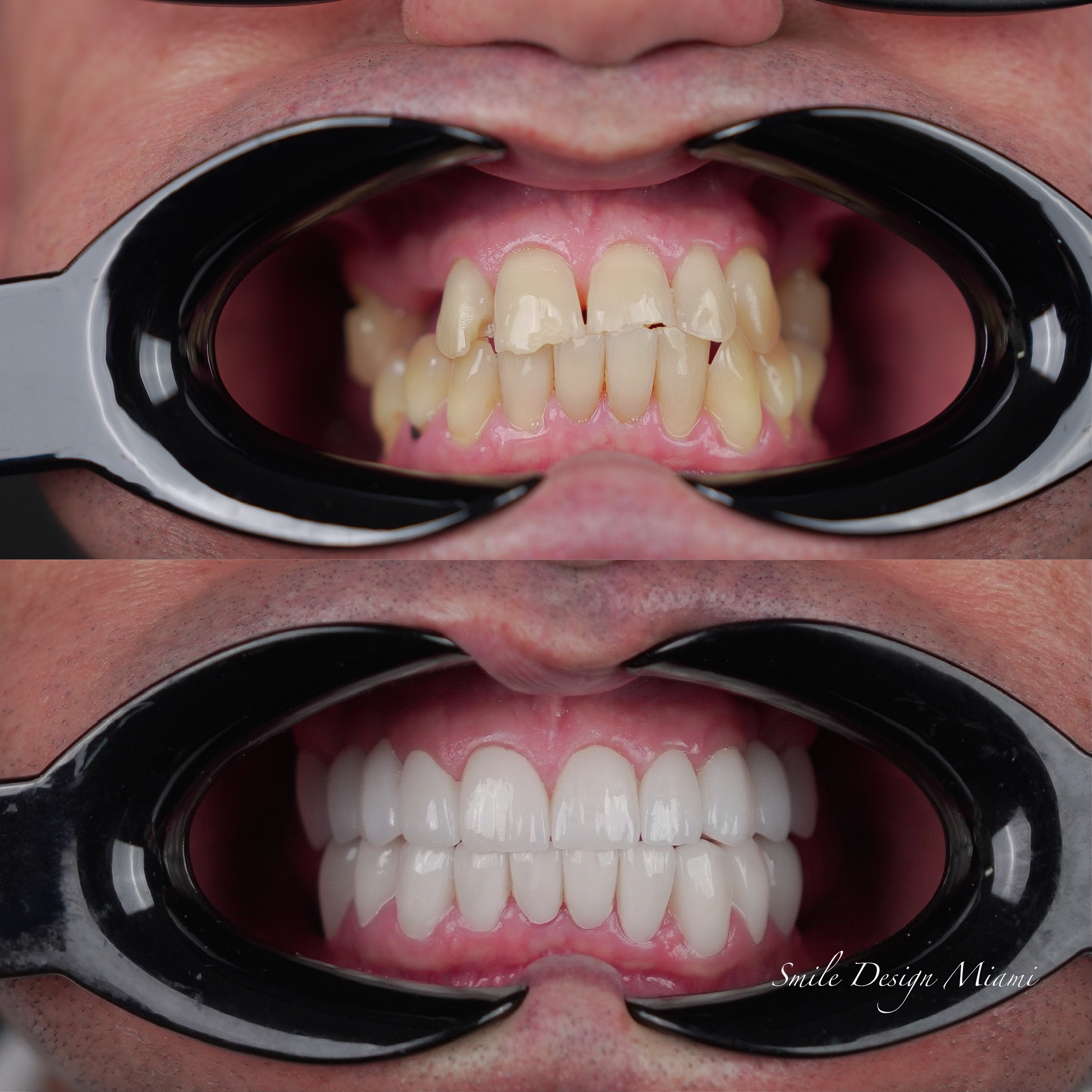 Before and After treatment comparison