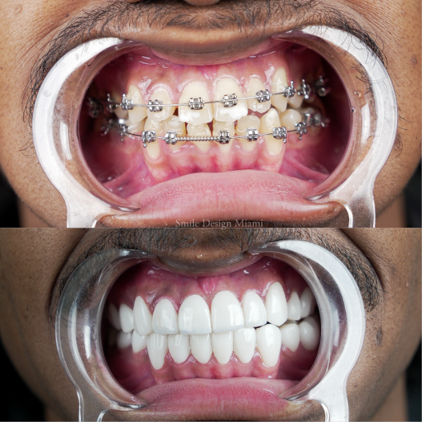 Orthodontics