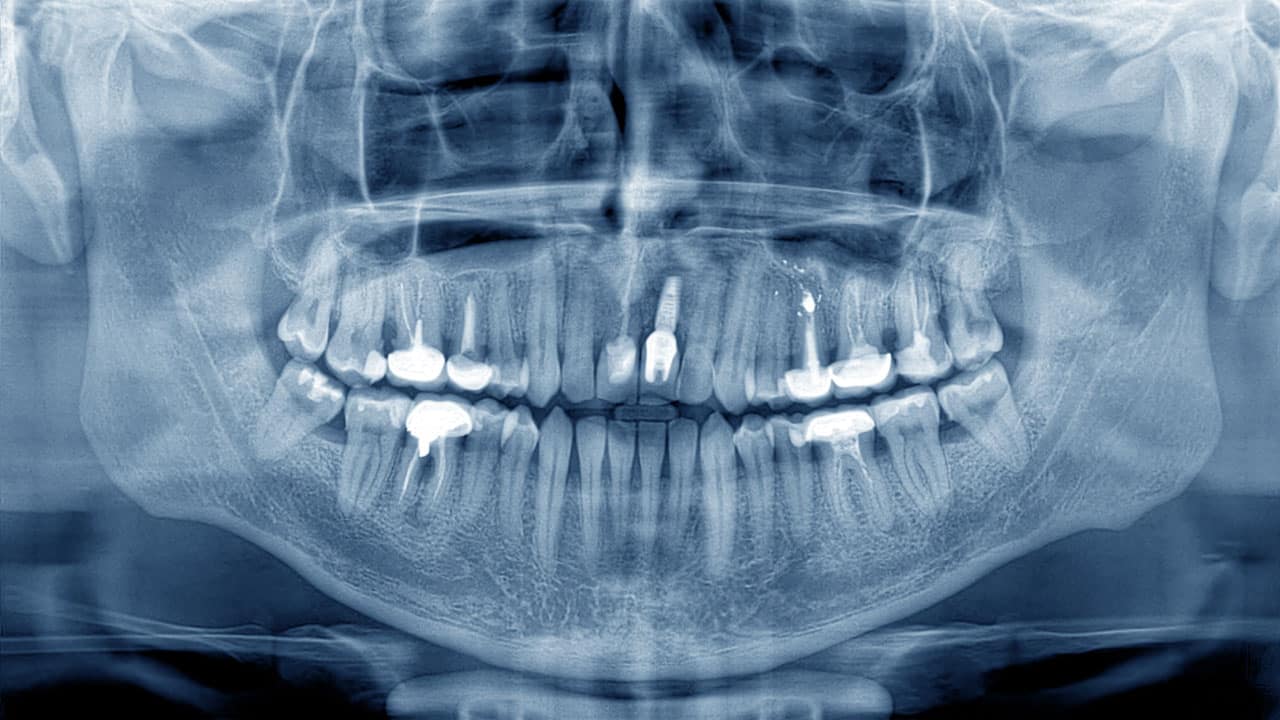 Radiographs