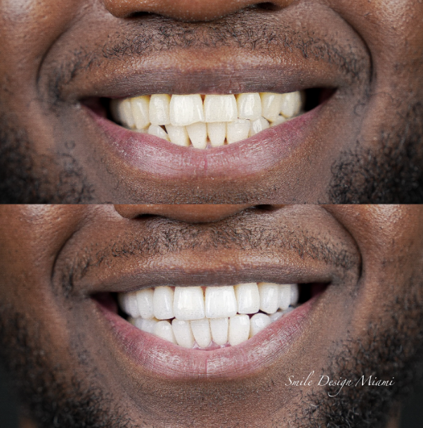 Cosmetic Dentistry