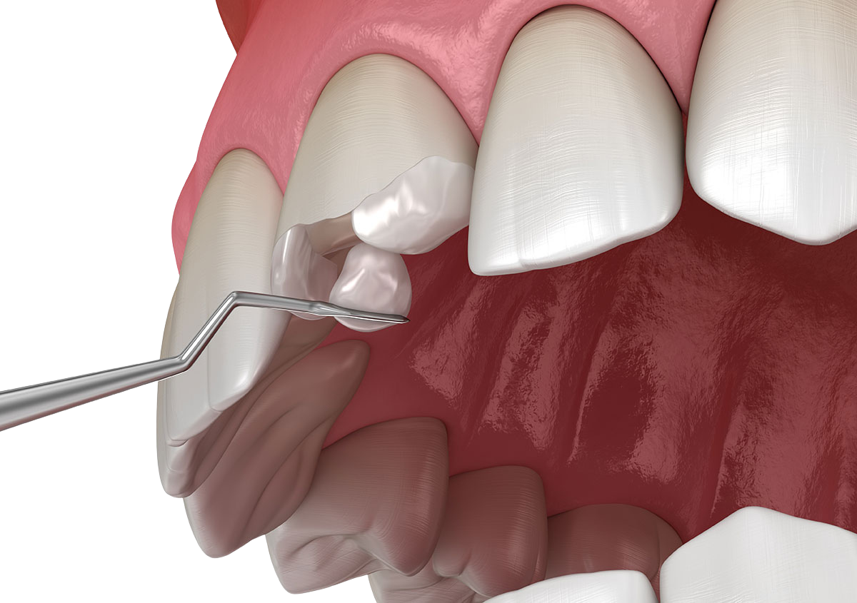 Restoration Dentistry